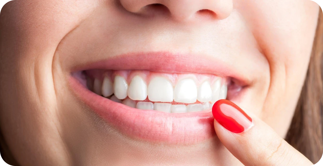 Votre sourire : Médical Smile, centres médico-dentaires Chartreux et Mazargues à Marseille