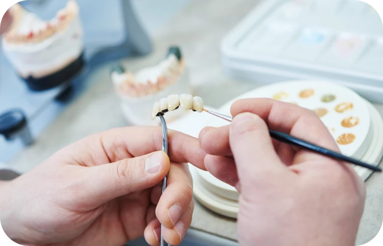 Prothèses dentaires au Centre Médico-dentaire Chartreux à Marseille, Médical Smile